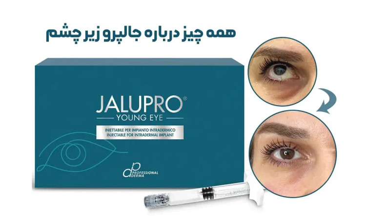 جالپرو زیر چشم یانگ ای کیفیت اصلی